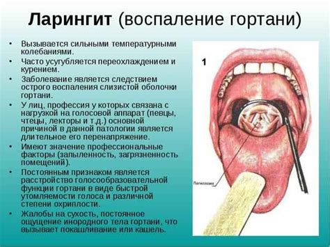 Анатомия миндалин и причины образования суппурации при воспалении миндалин