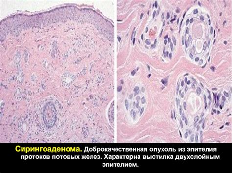 Блокировка потовых желез