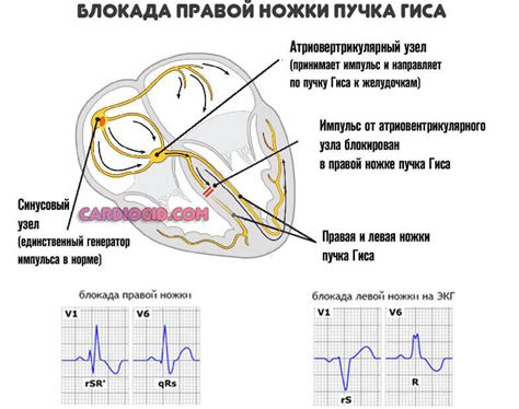 Важность выявления и подходы к лечению изменений сердечной мышцы левого желудочка по данным электрокардиографии (ЭКГ)