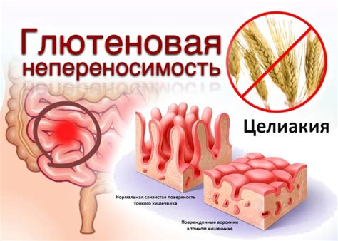 Вариант для людей с целиакией и непереносимостью глютена