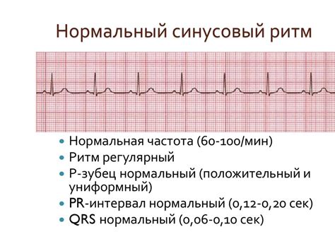 Взрослые и нерегулярный синусовый ритм