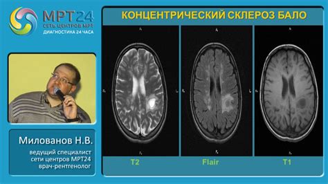 Виды патологических изменений в головном мозге