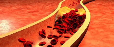 Влияние жареной и жирной пищи на процесс кровотечения