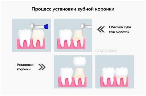 Влияние ключевых факторов на долговечность выключателя