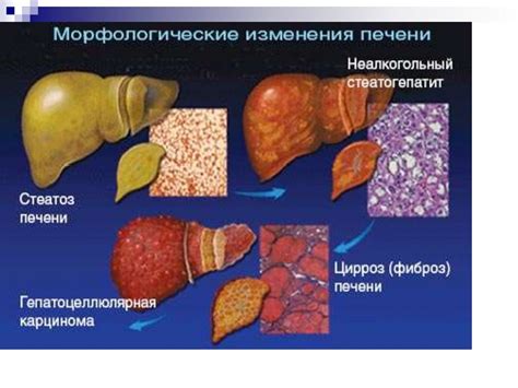 Влияние мела на работу пищеварительной системы: возможные негативные последствия