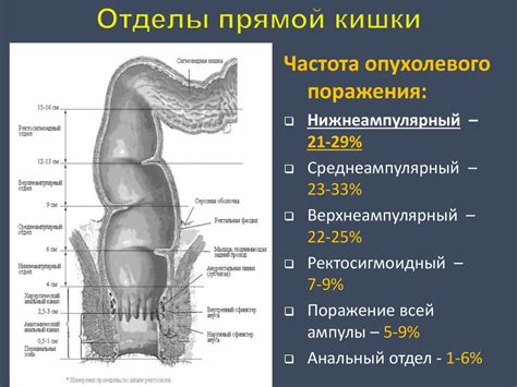 Влияние нарушений работы прямой кишки на пищеварение