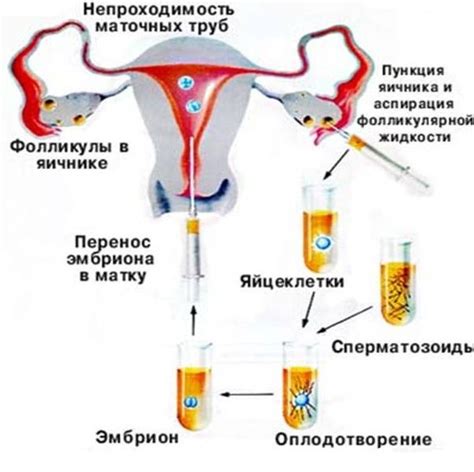 Влияние процесса стимуляции на свойства яйцеклеток