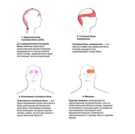 Влияние психоэмоционального напряжения на возникновение головной боли у мужчин