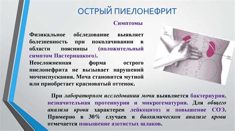 Влияние физиологических факторов на отрицательный результат симптома Пастернацкого