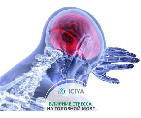 Влияние эмоционального стресса на появление интенсивной головной боли