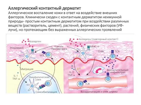 Воздействие внешних факторов на защитную оболочку кожи