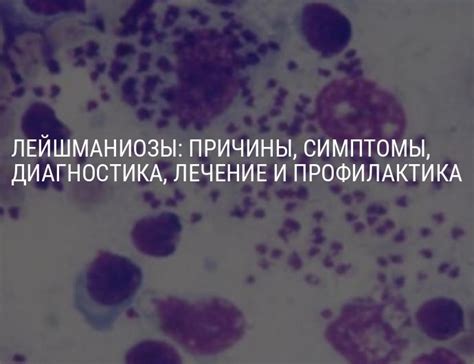 Диагностика и лечение микроанизоцитарной формы анизоцитоза