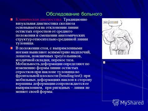 Диагностика и обследование при нарушении целостности апоневроза срединной линии на животе