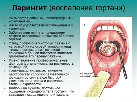 Диагностика ларингита: основные методы исследования для выявления АБС