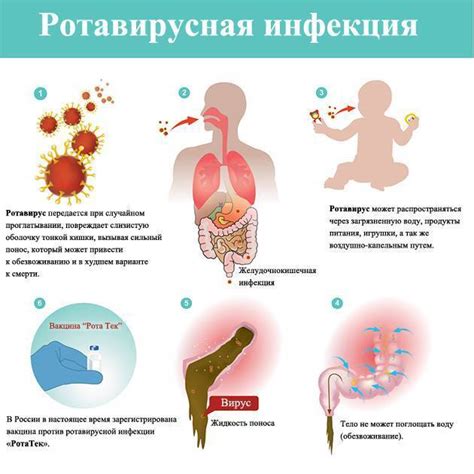 Диагностика ротовирусной инфекции