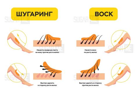 Длительный эффект: Что лучше – шугаринг или воск?