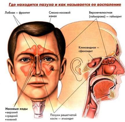 Дополнительные рекомендации для смягчения состояния при отечном состоянии в области носа в результате аллергической реакции