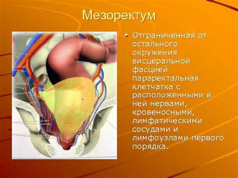 Заболевания прямой кишки