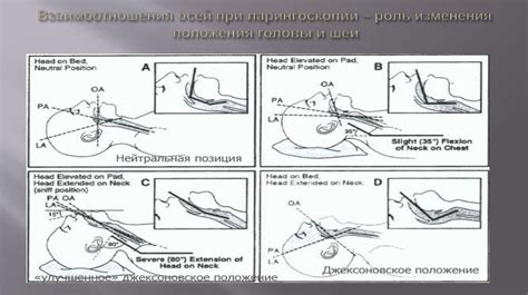 Защитные механизмы кроличьей шеи: роль наклона головы