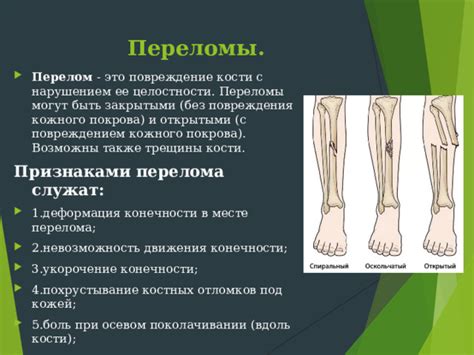 Знакомство с признаками и симптомами перелома конечности