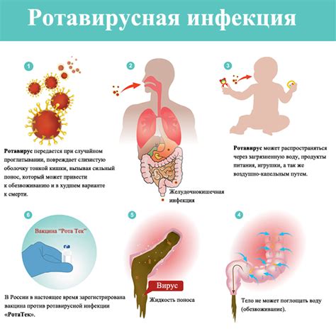 Значение адекватного питания при вирусной инфекции ротоглотки у детей младше года