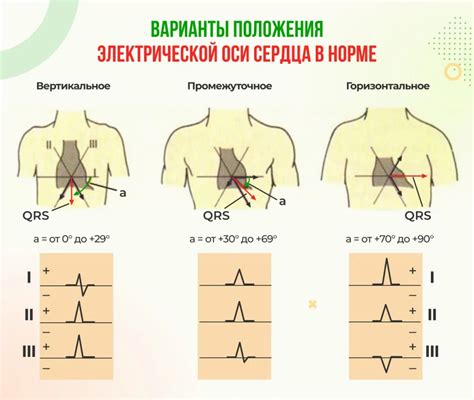 Значение анализа горизонтального положения эквивалента оси сердца при интерпретации электрокардиограммы