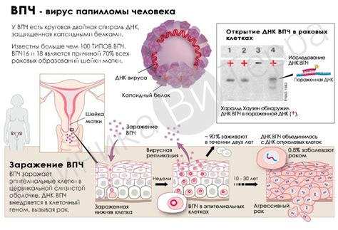 Значение генетической информации вируса ВПЧ 16 типа для развития онкологических заболеваний