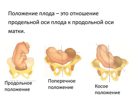 Значение для будущего малыша: продольное предлежание головное