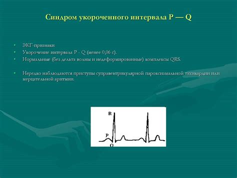 Значимость укорочения PQ на ЭКГ у младенцев и ребенках