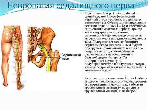 Инновационные подходы к восстановлению нормального положения седалищного нерва