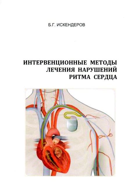 Интервенционные методы лечения артериовенозных нарушений сердца