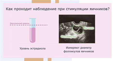 Какие признаки возникают при повышенной стимуляции яичников?