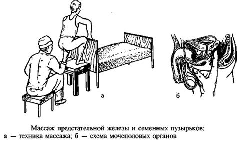 Как выбрать оптимальную позицию и положение для проведения массажа простаты