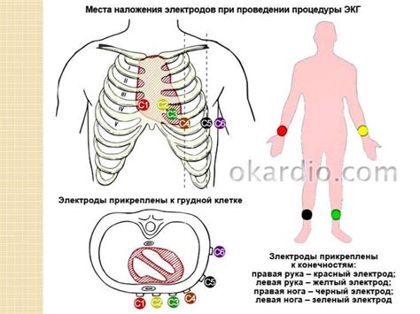 Как выявить специфическую форму ЭКГ у маленького пациента?