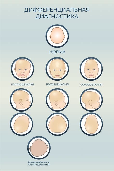 Когда наступает момент, когда необходимо начинать лечение видимых изменений формы головы у младенцев?