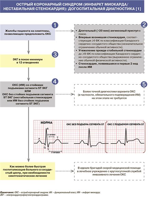 Критерии диагностики изменений структуры левого сердечного камерного миокарда при оценке данных ЭКГ