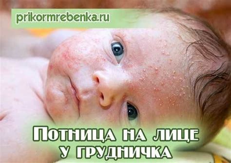 Лечение потницы на лице у грудничка с помощью народных средств