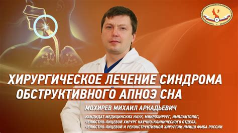 Медикаментозные подходы к лечению апноэ сна