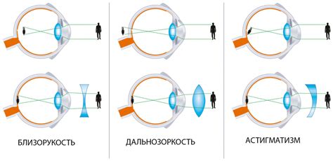 Методы, которые способствуют сохранению здоровья зрения и его улучшению