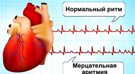 Методы для увеличения сердечного ритма: эффективные стратегии