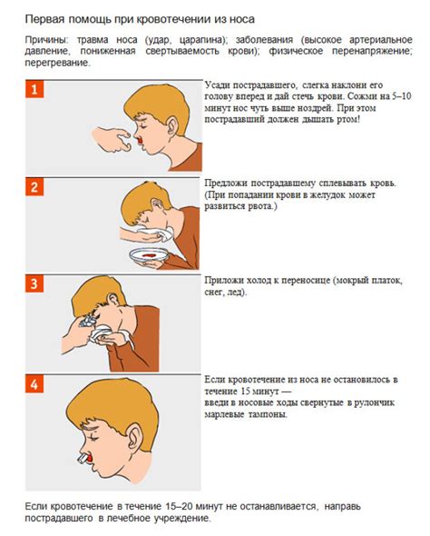 Методы остановки кровотечения из носа