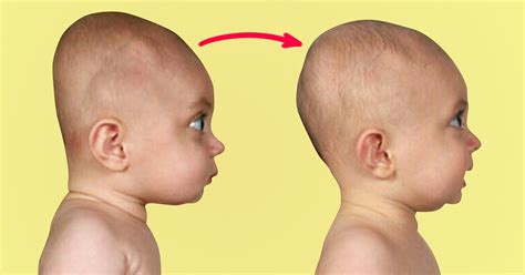 Мифы о необычном форме головы у новорожденных