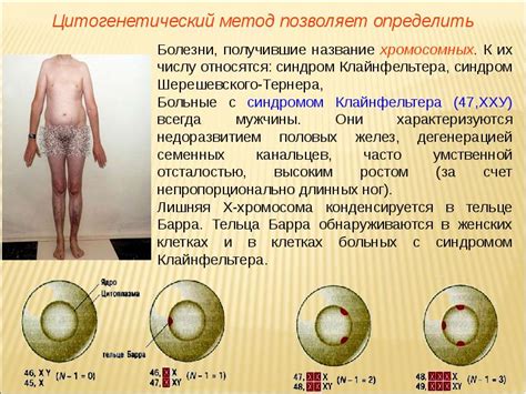 Наследственность и вероятность рождения ребенка с синдромом Клайнфельтера