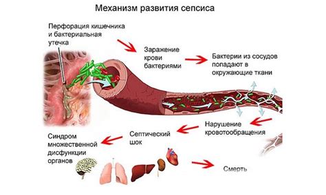 Невисцеральные заболевания: основные причины и симптомы