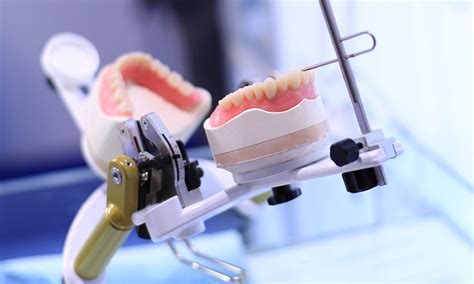 Обеспечение надежности и проверка качества установленного внутриротового ортодонтического протеза