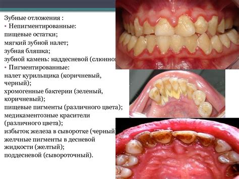 Образование отложений и способы их удаления