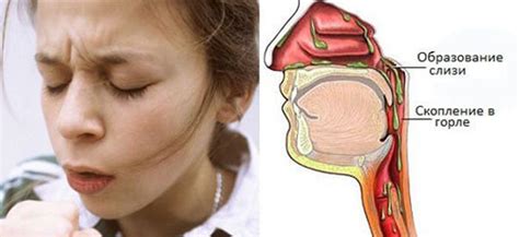 Образование соплей в носоглотке: что это и как возникает?