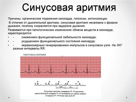 Обращаем внимание на состояние сердечных ритмов