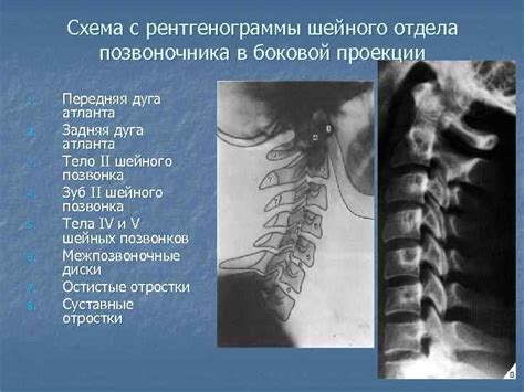 Ознакомление с состоянием паравертебральной области шейного сегмента позвоночника