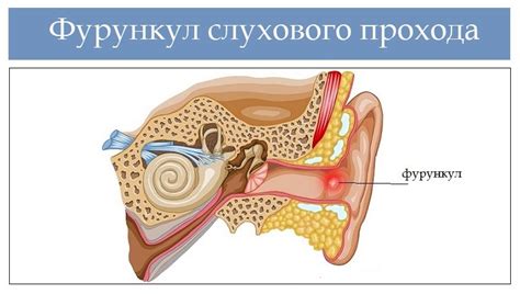 Опасность проявления кровотечения из слухового прохода